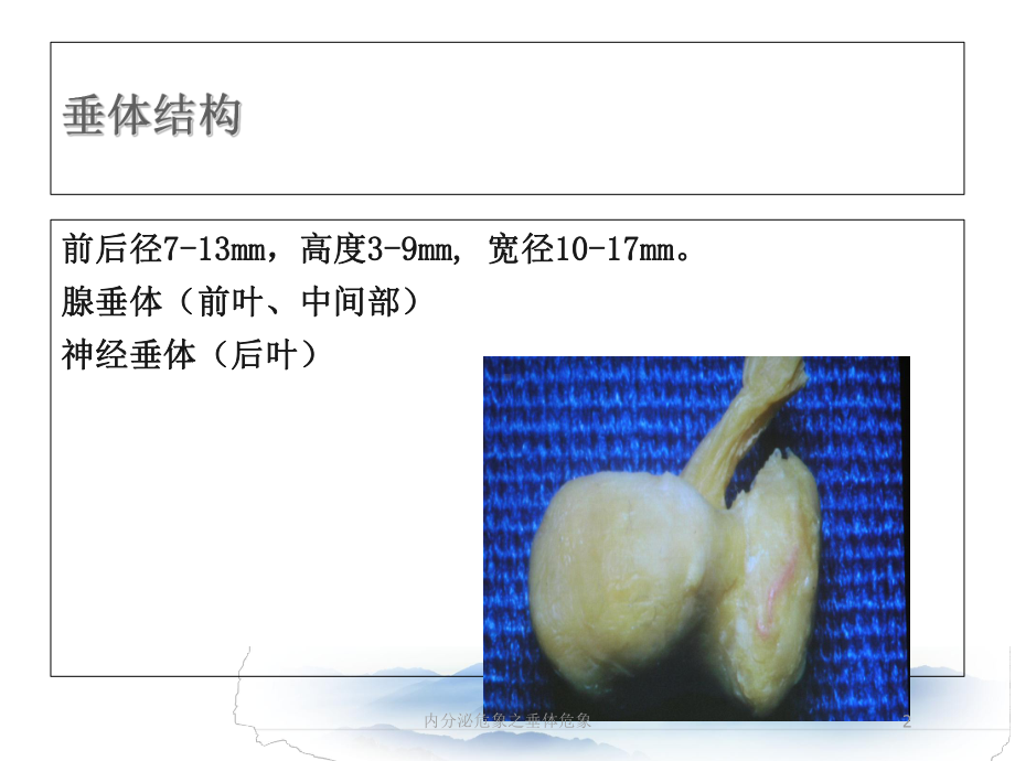 内分泌危象之垂体危象培训课件.ppt_第2页