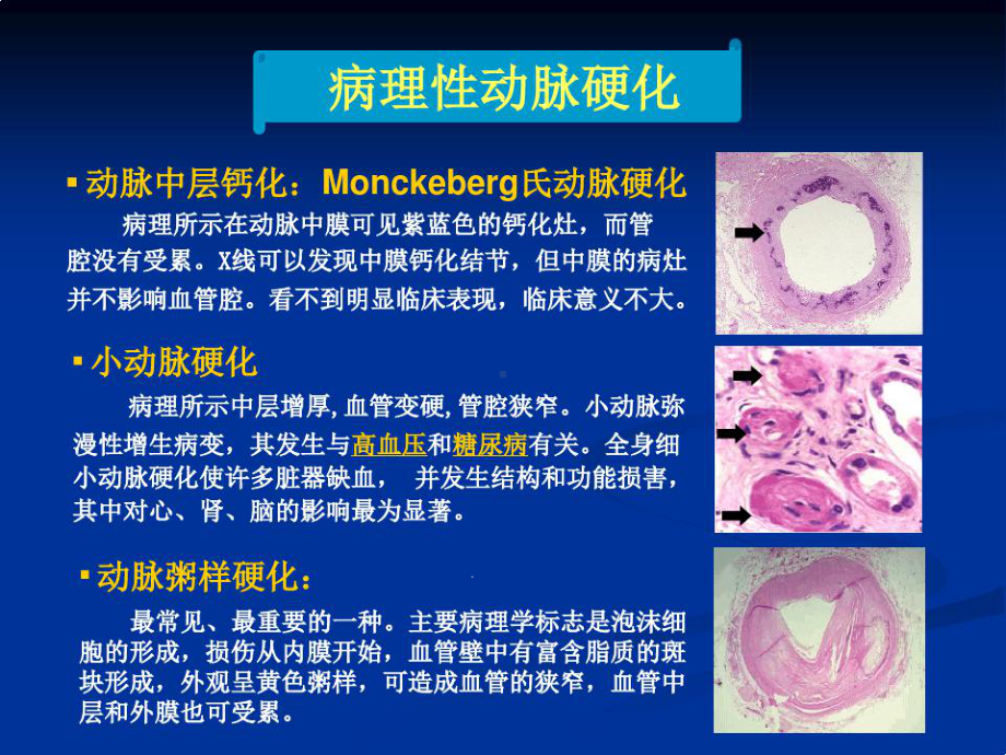 全面干预动脉粥样硬课件.ppt_第3页