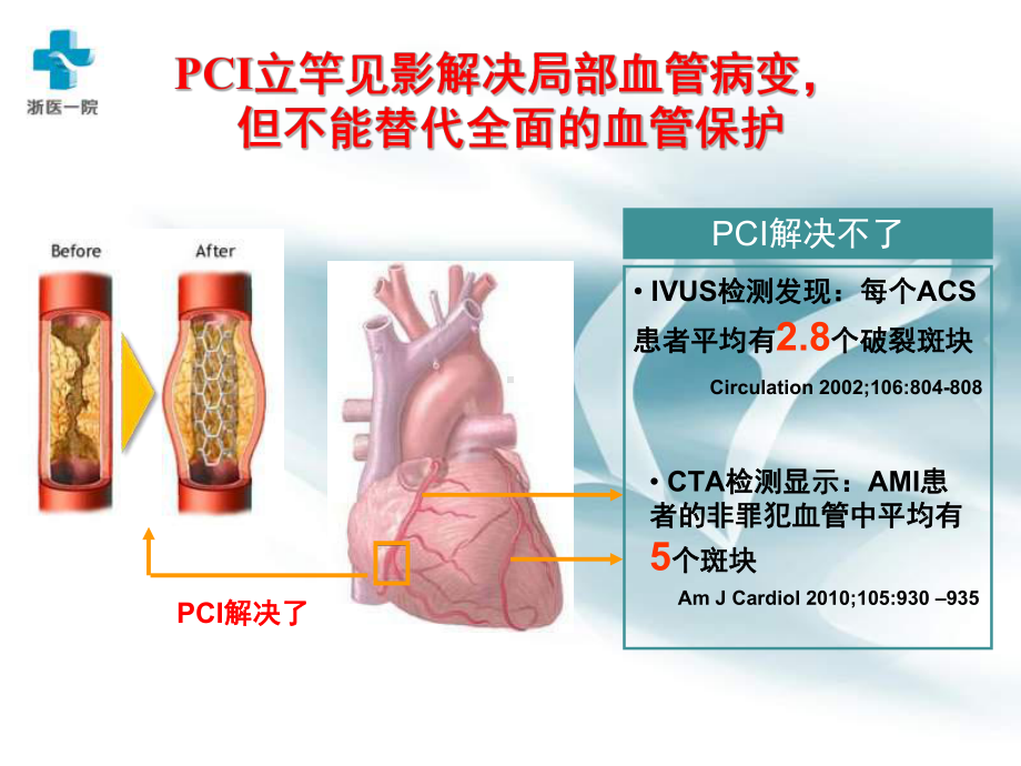 冠心病二级预防的他汀管理临床常见问题探讨课件.ppt_第2页