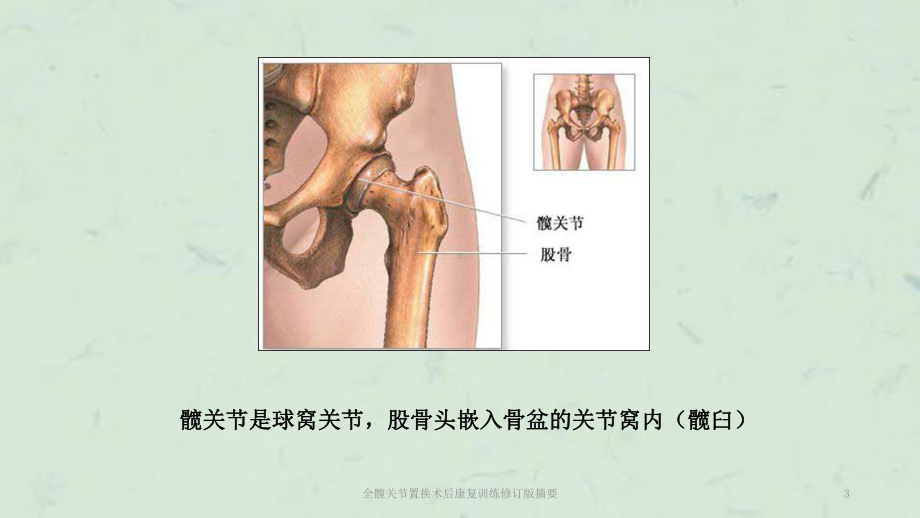 全髋关节置换术后康复训练修订版摘要课件.ppt_第3页