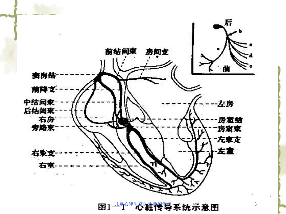 儿童心律失常的诊断和治疗培训课件.ppt_第3页