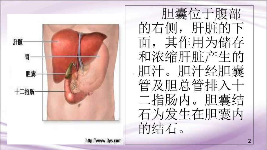 医学课件-胆囊结石护理查房课件.ppt_第2页