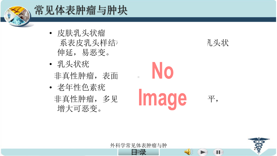 外科学常见体表肿瘤与肿块培训课件.ppt_第2页