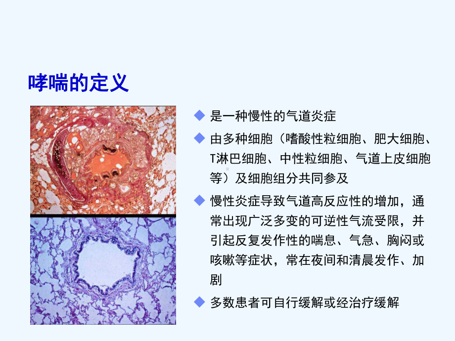 吸入糖皮质激素在哮喘治疗中的地位与应用课件.ppt_第2页