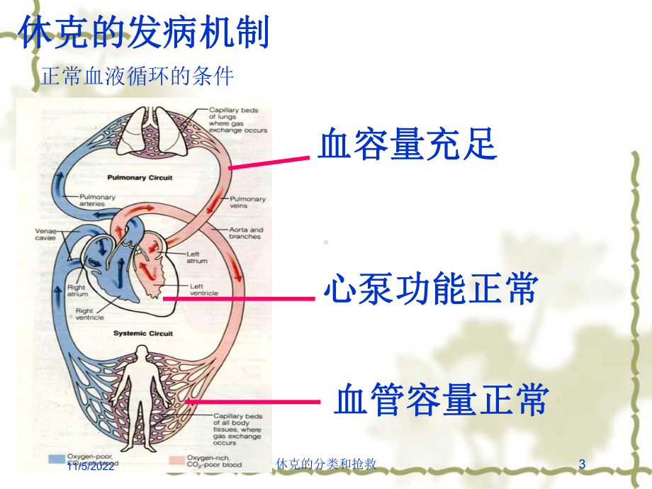 休克的分类和抢救培训课件.ppt_第3页