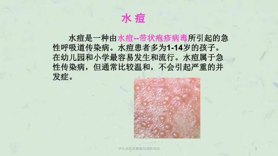 学生水痘流腮腹泻预防知识课件.ppt_第3页