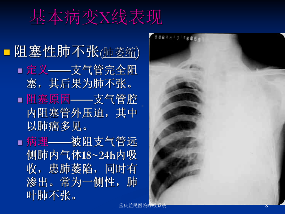 呼吸系统课件.ppt_第3页