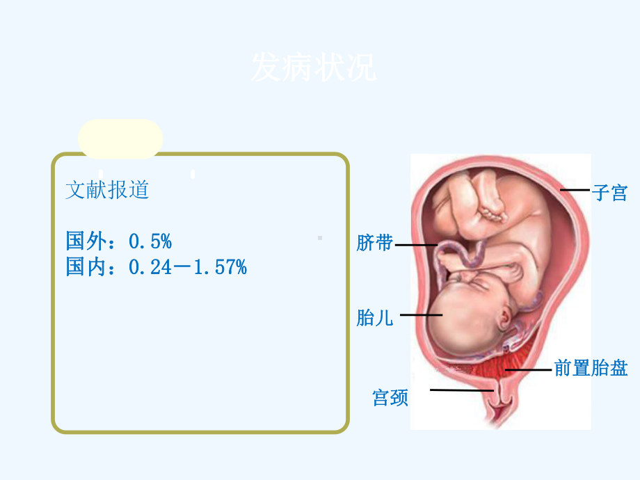 前置胎盘查房课件.ppt_第2页