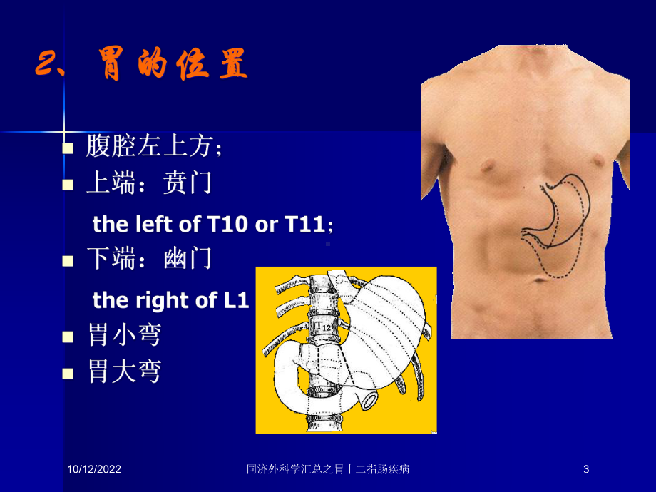 外科学汇总之胃十二指肠疾病课件.ppt_第3页