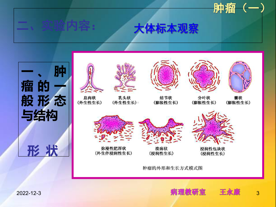 实习四肿瘤1课件.ppt_第3页