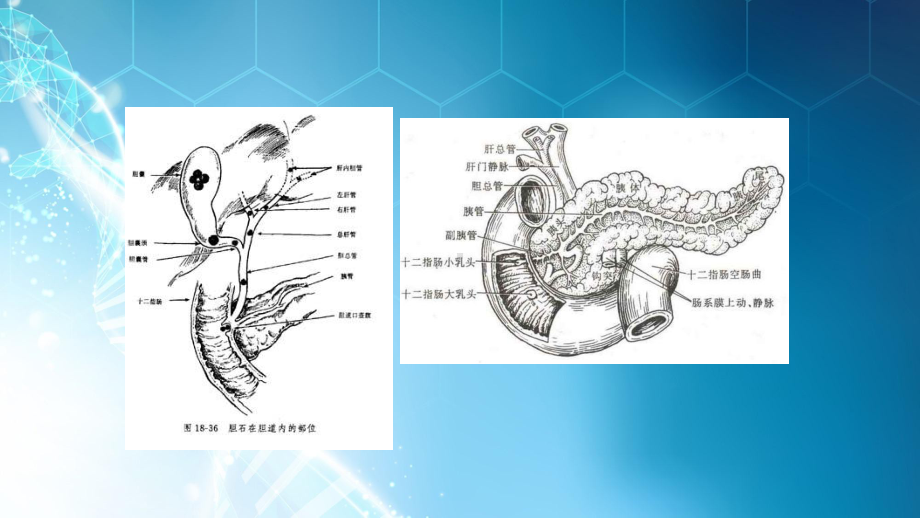 壶腹部占位课件.pptx_第3页