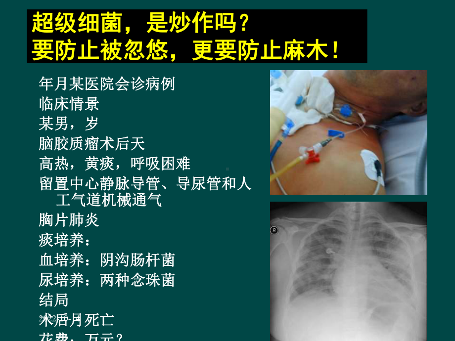 多重耐药鲍曼不动杆菌预防治疗课件.ppt_第3页