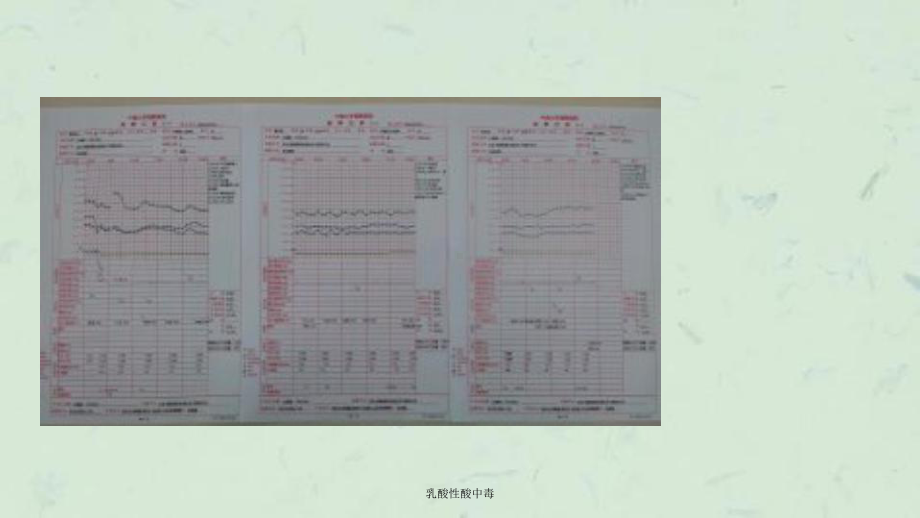 乳酸性酸中毒课件.ppt_第3页