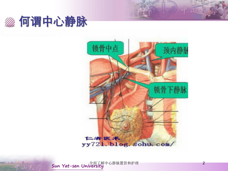 全面了解中心静脉置管和护理培训课件.ppt_第2页