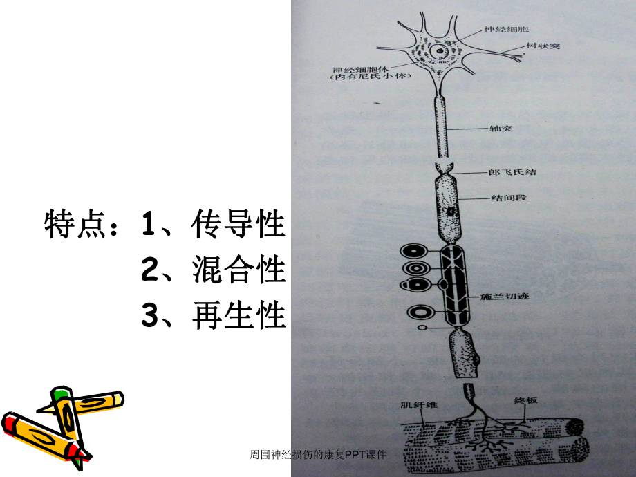 周围神经损伤的康复课件培训课件.ppt_第3页