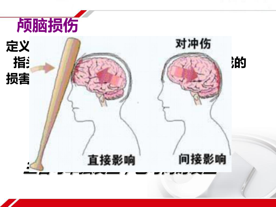 医学颅脑损伤病人的护理培训课件.ppt_第2页