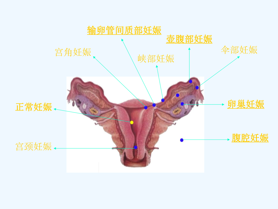 妇科急腹痛诊治思路课件.ppt_第3页