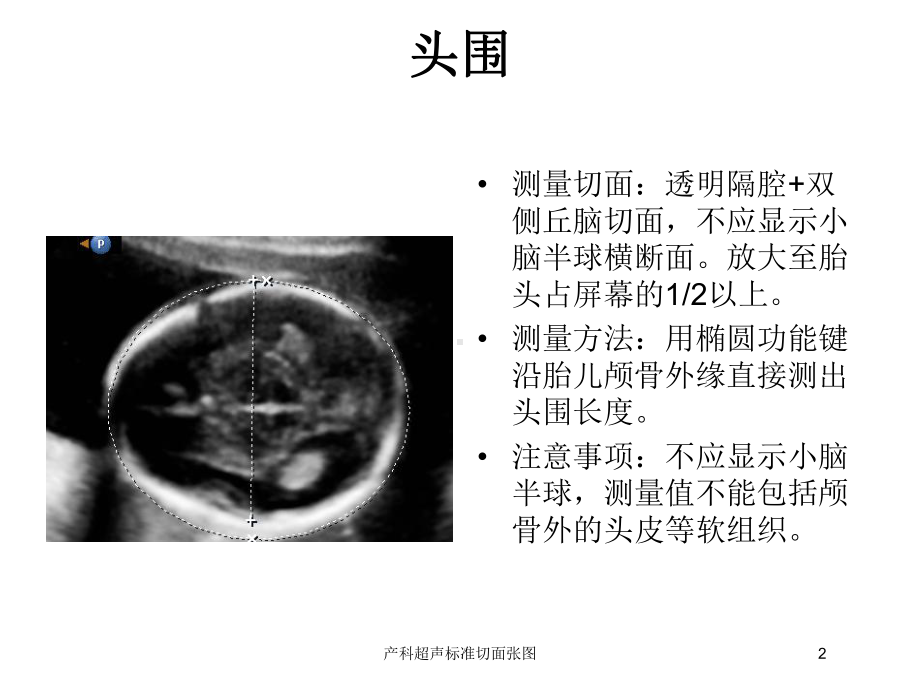 产科超声标准切面张图培训课件.ppt_第2页