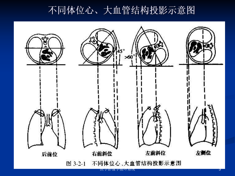 医学影像学循环系统课件.ppt_第3页