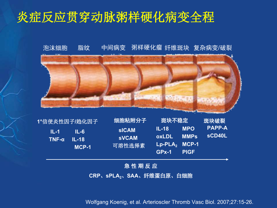 冠心病抗血小板治疗与出血对策课件.ppt_第2页