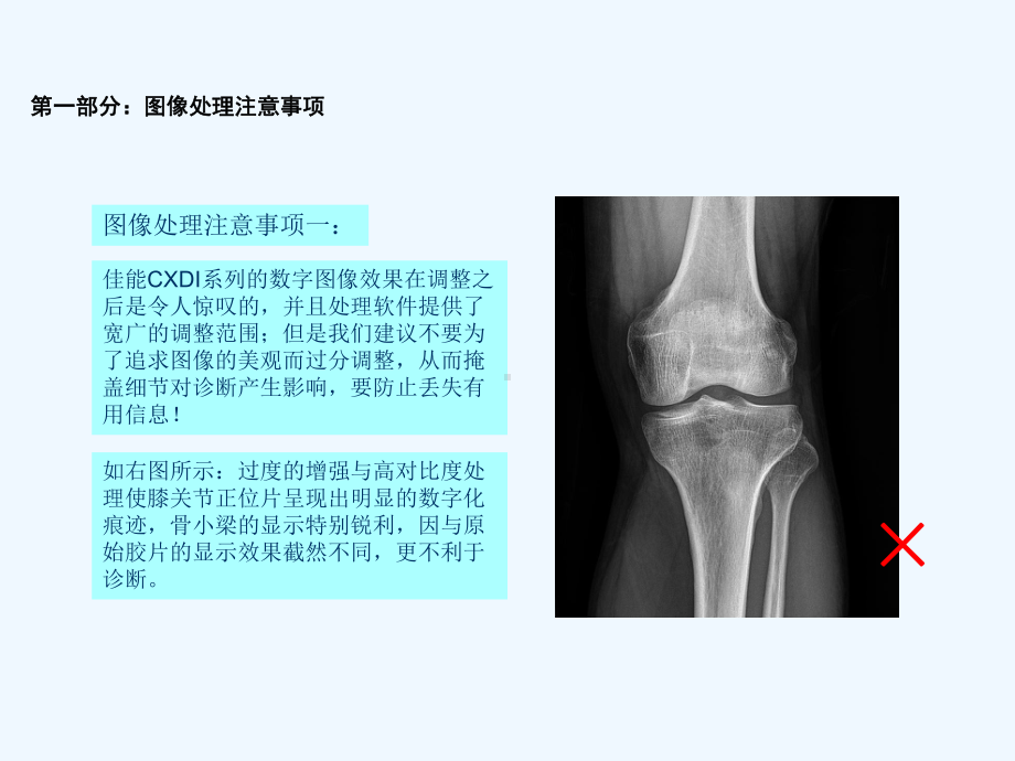 佳能CXDI数字成像系统床边机(放射科医师使用)课件.pptx_第3页