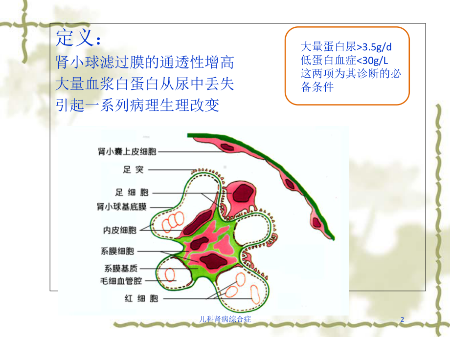 儿科肾病综合症培训课件.ppt_第2页