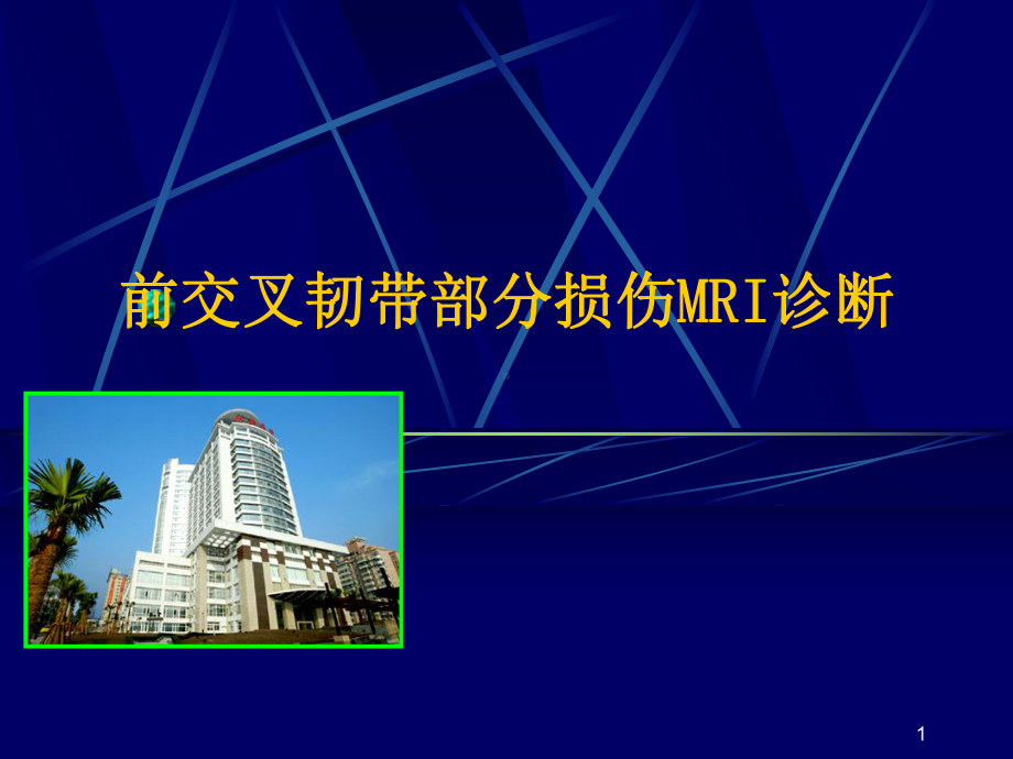 前交叉韧带部分损伤MRI诊断演示文稿课件.ppt_第1页