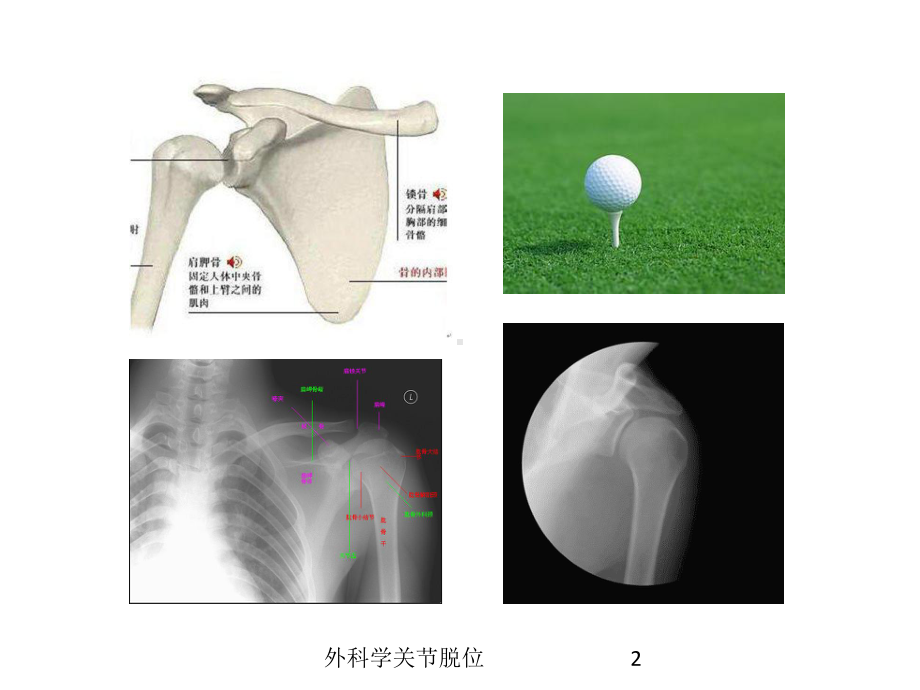 外科学关节脱位培训课件.ppt_第2页