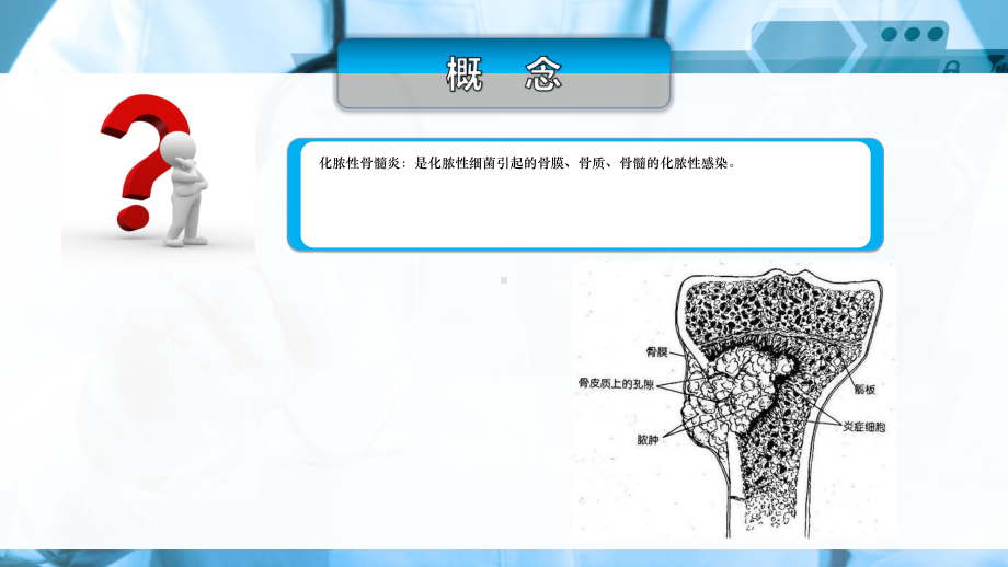 外科护理第二十章第四节化脓性骨髓炎病人护理课件.ppt_第3页