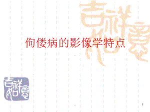 佝偻病的影像学特点教学课件.ppt