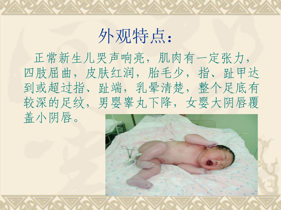 医学正常新生儿的护理课件.ppt_第3页