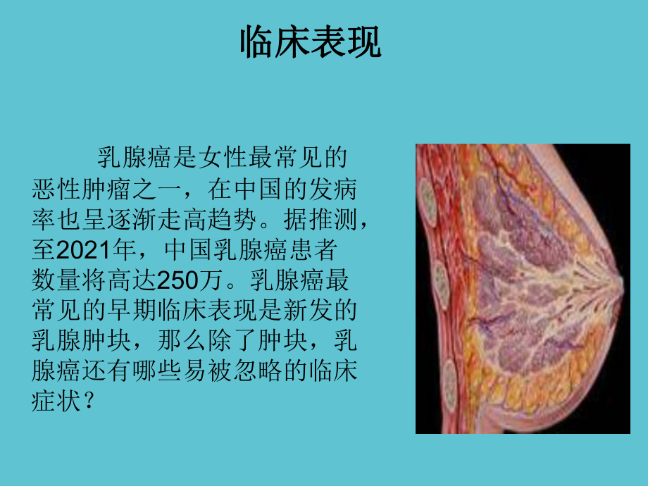 乳腺癌的知识课件-2.ppt_第3页