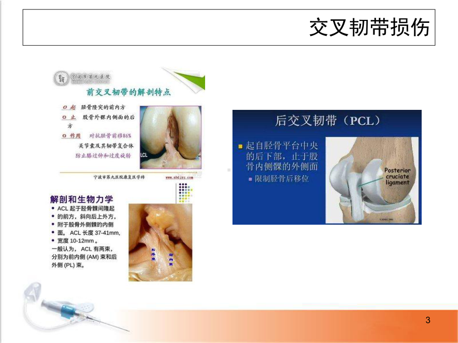 医学课件-膝关节常见病课件.ppt_第3页