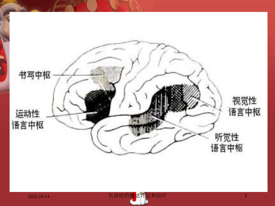 失语症的概述评定和治疗课件.ppt_第3页