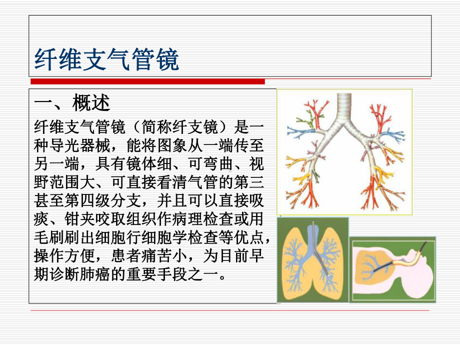 呼吸科常用诊疗技术精选课件.ppt_第3页