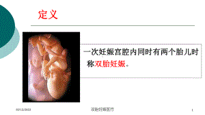 双胎妊娠医疗课件.ppt