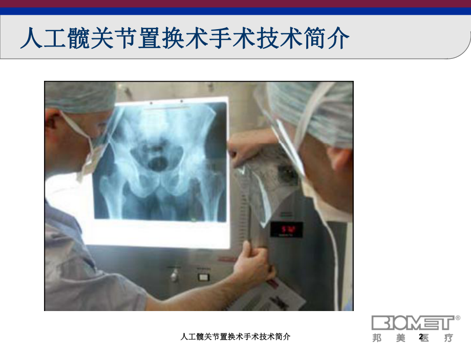 人工髋关节置换术手术技术简介培训课件.ppt_第2页