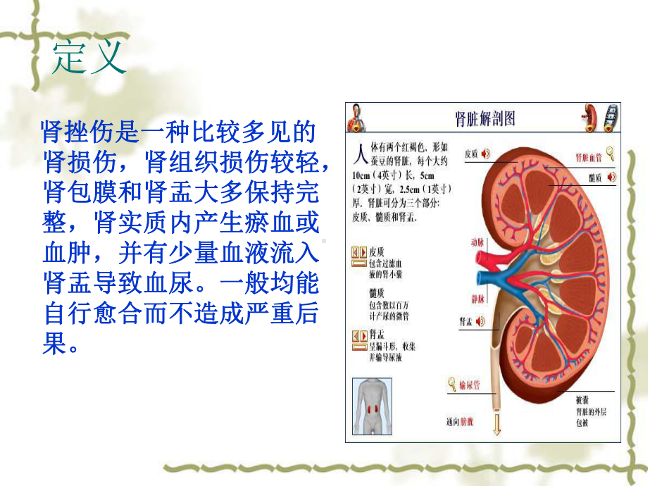 医学肾挫伤病人的护理查房专题培训课件.ppt_第2页