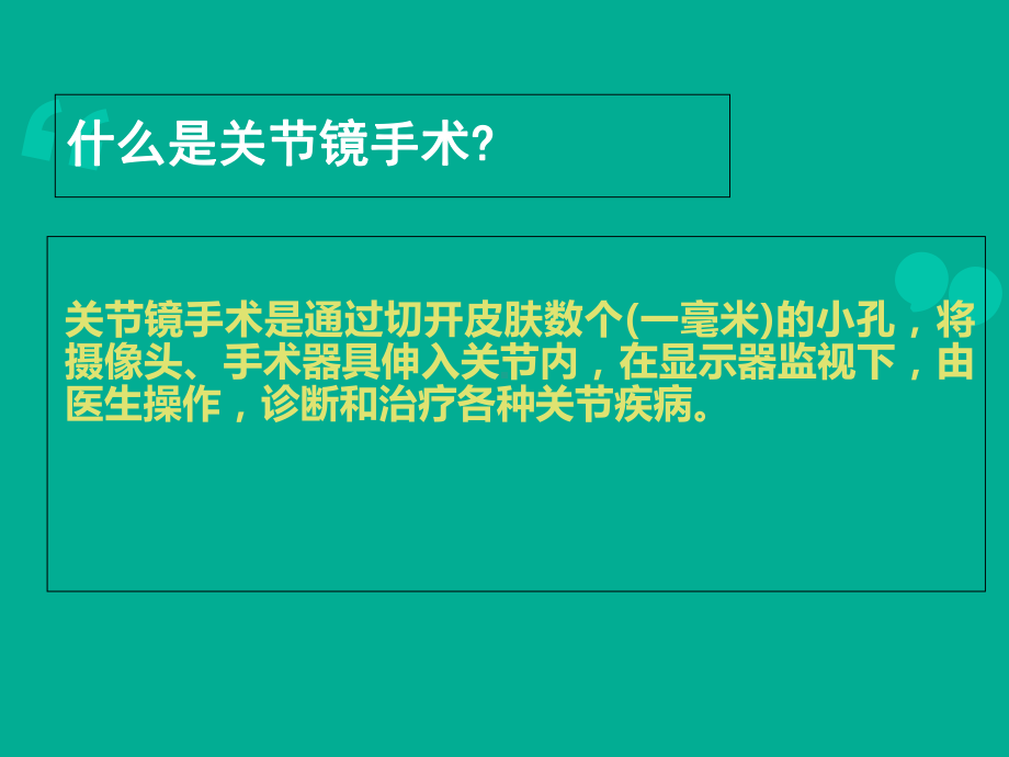 关节镜关节镜下膝关节探查清理术课件.ppt_第2页