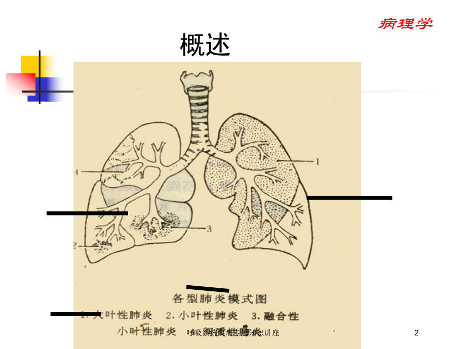 呼吸系统疾病专题知识讲座培训课件.ppt_第2页