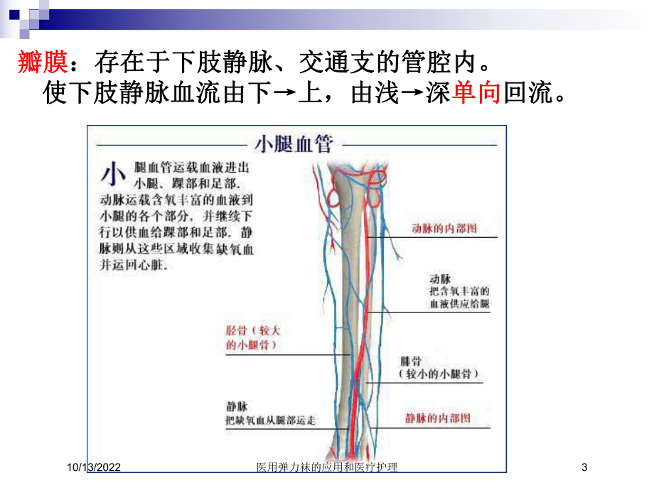 医用弹力袜的应用和医疗护理课件.ppt_第3页