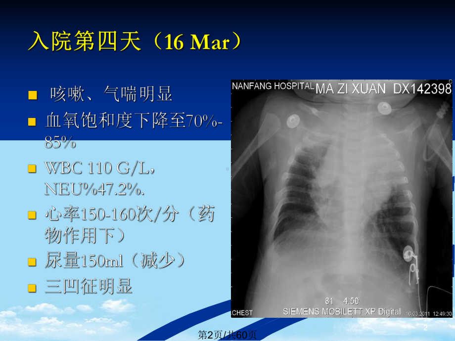 儿科肺炎全面版课件.pptx_第2页