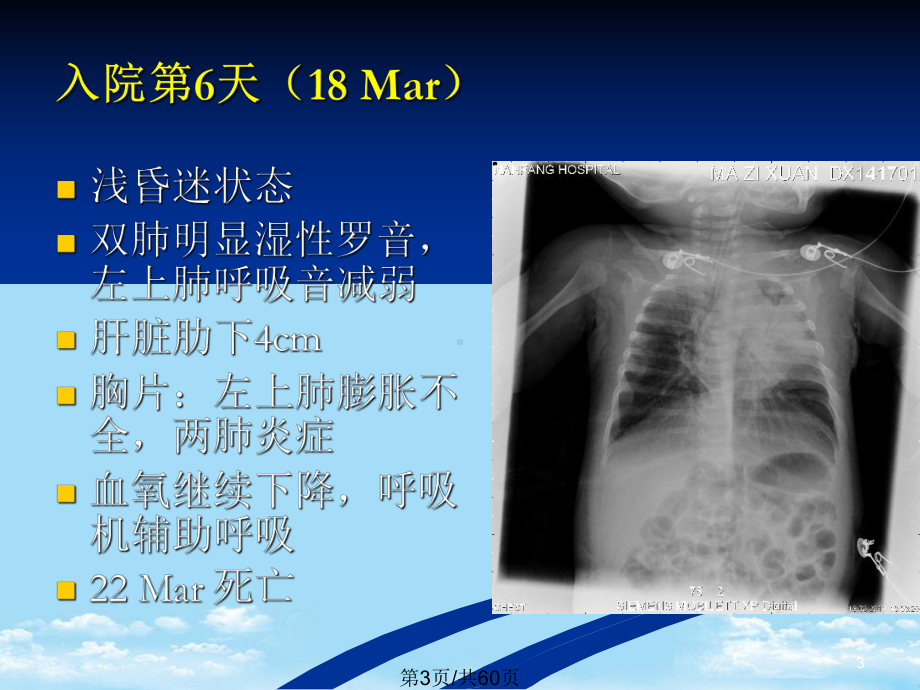 儿科肺炎全面版课件.pptx_第3页