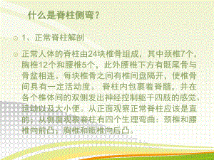 医学课件脊柱侧弯宣传稿.ppt