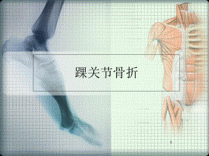 医学课件-踝关节骨折课件.ppt