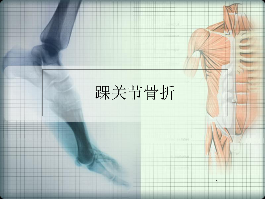 医学课件-踝关节骨折课件.ppt_第1页