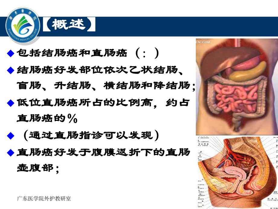 大肠癌及人工肛门护理课件.ppt_第2页