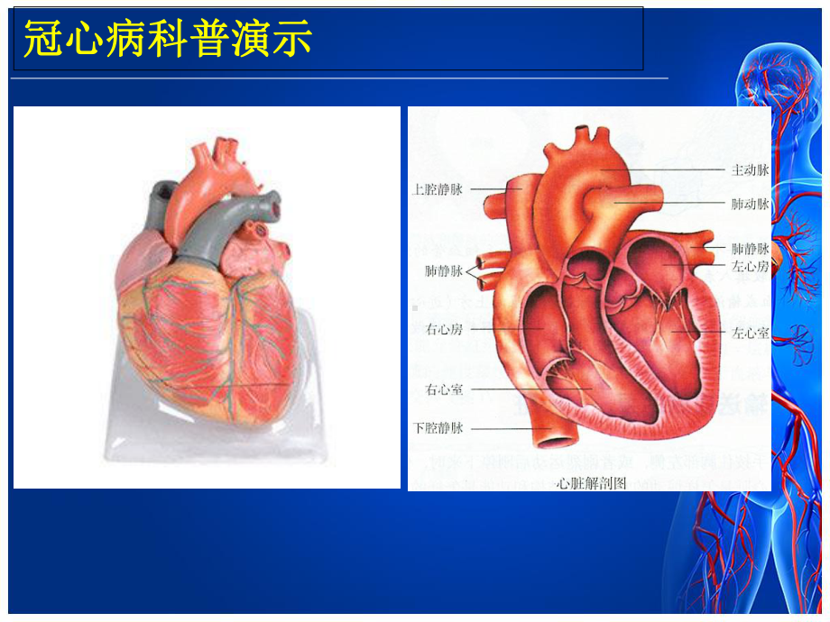 冠心病科普演示-课件.ppt_第3页