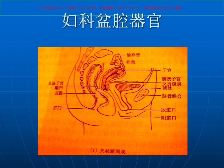 妇产超声医学知识讲座培训课件.ppt_第3页