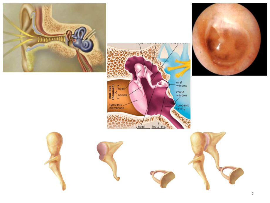 保护我们耳朵鼻子咽喉课件.ppt_第2页
